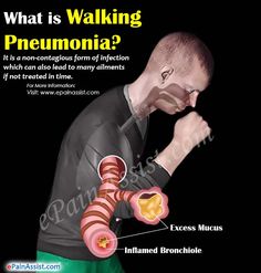 Symptoms of Walking Pneumonia